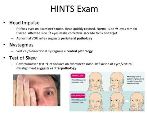 vertigo package test|clinical evaluation of vertigo.